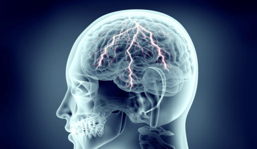 How Does TMS Work?