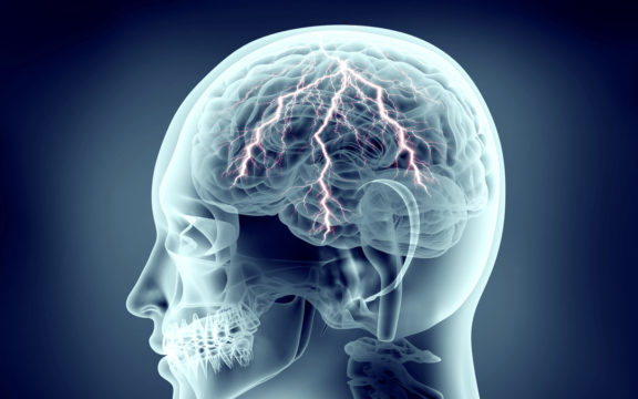 How Does TMS Work?