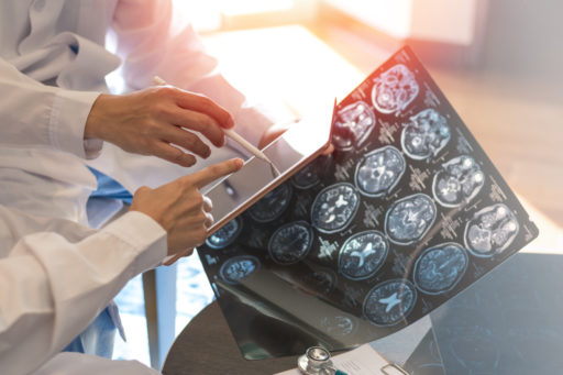 Depression and Multiple Sclerosis